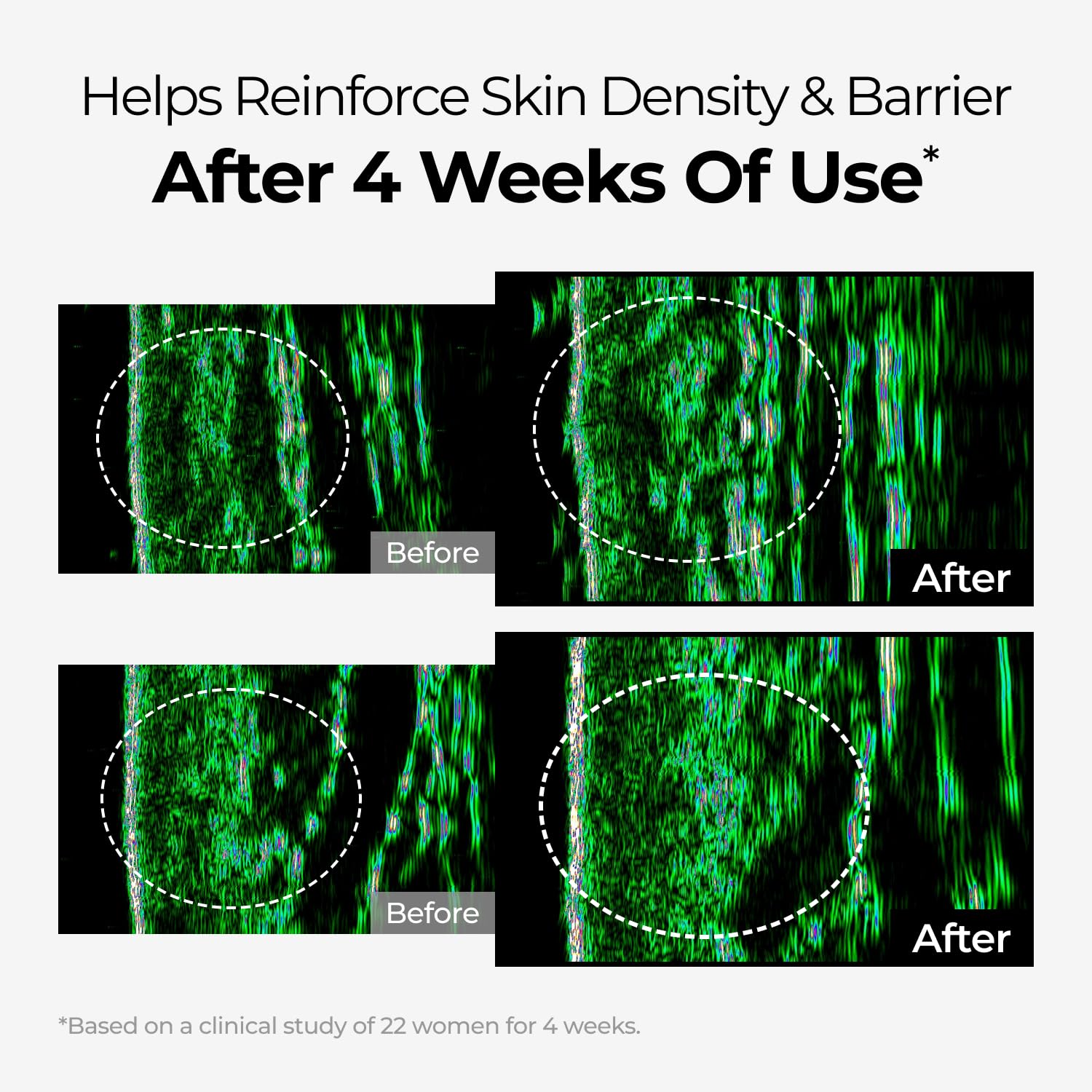 Product ingredients packshot emphasizing niacinamide and tranexamic acid benefits