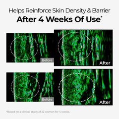 Product ingredients packshot emphasizing niacinamide and tranexamic acid benefits