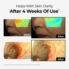 Hands warming the cream to improve skin absorption and comfort