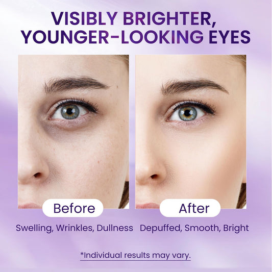 Doracome under-eye area depuffing application for quick daytime refresh.