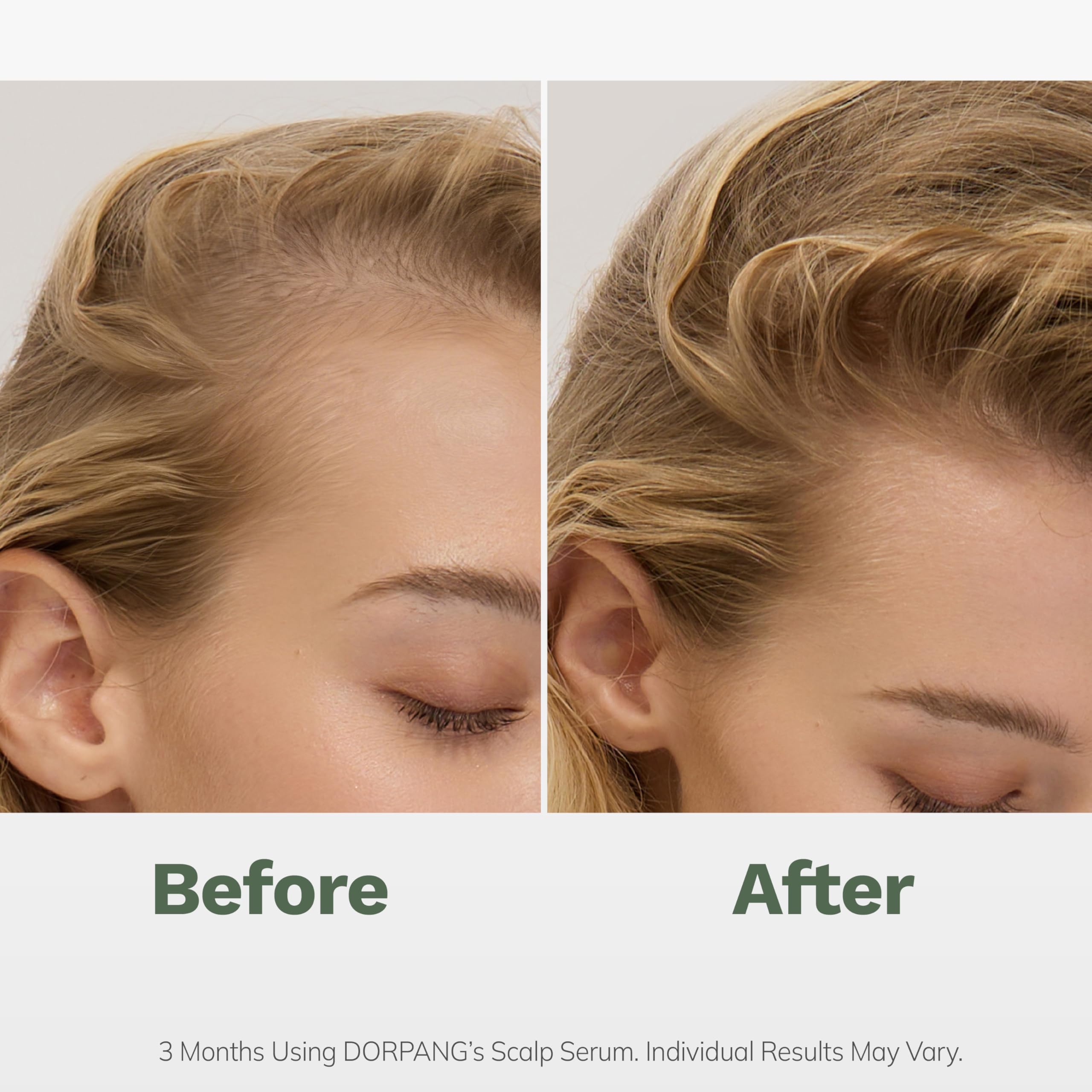 DORPANG serum applied to scalp illustrating nourishing care for a fuller-looking head.
