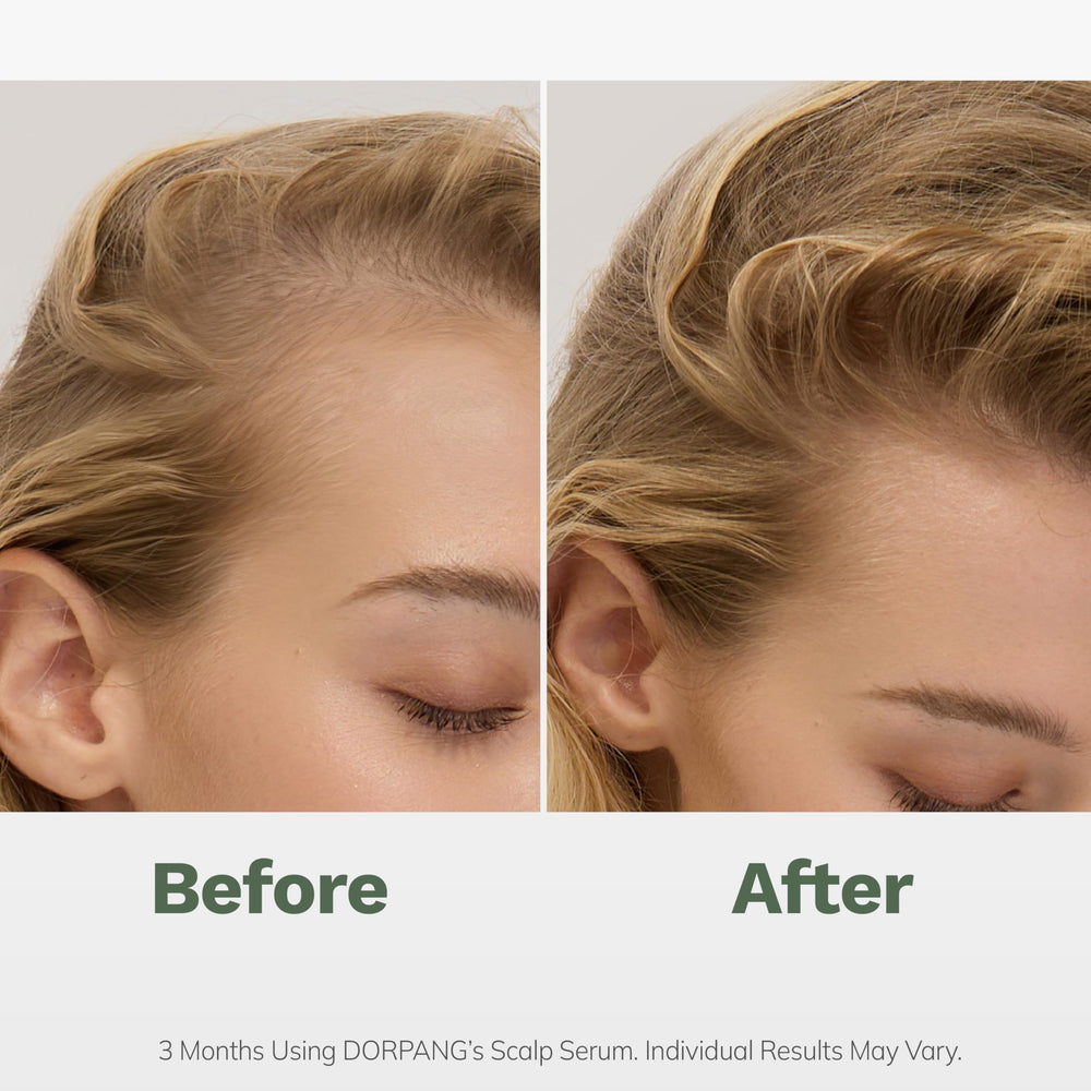DORPANG serum applied to scalp illustrating nourishing care for a fuller-looking head.