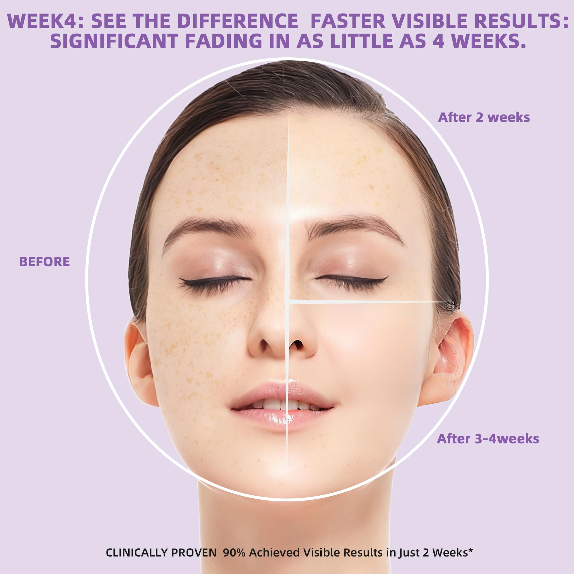 DQOJVU dark spot remover diminishes acne marks for clarity