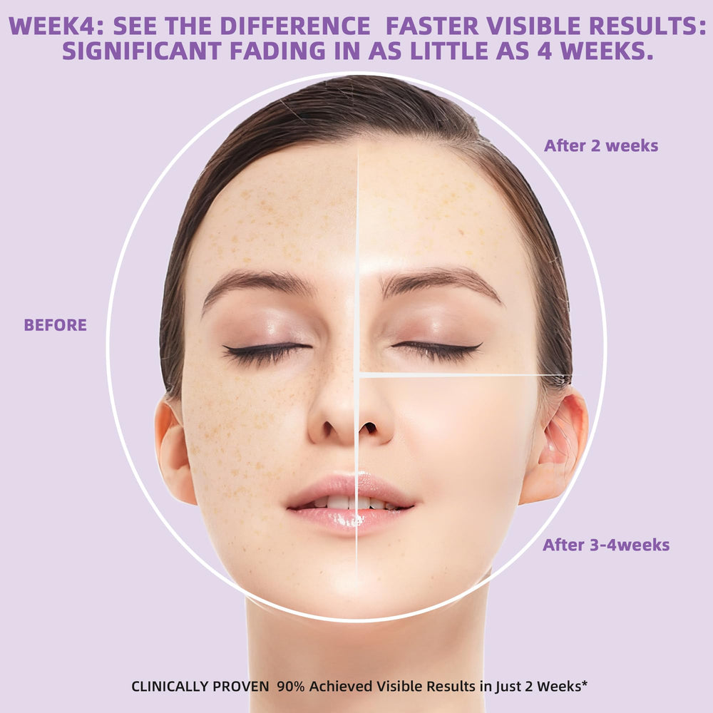 DQOJVU dark spot remover diminishes acne marks for clarity