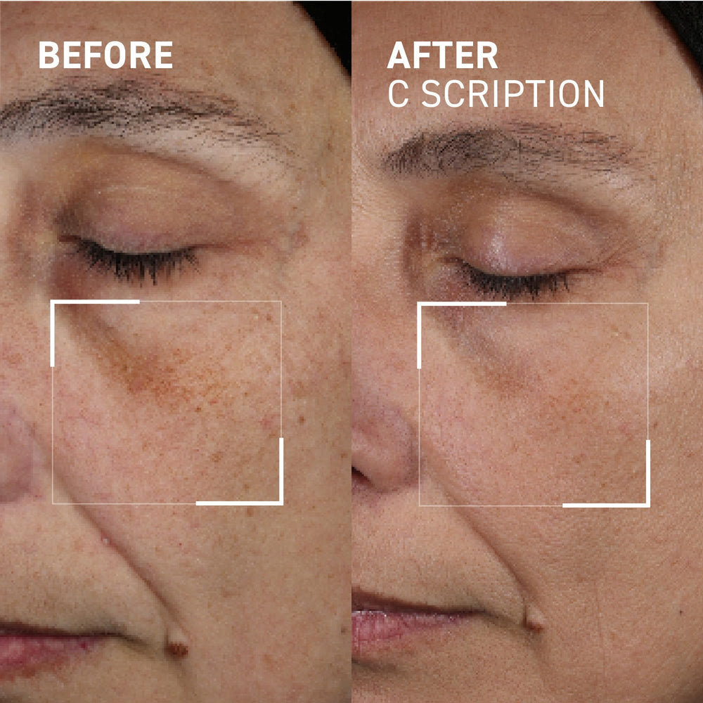 Dr. Brandt Bright This Way C Scription serum applied to the face for quick absorption.