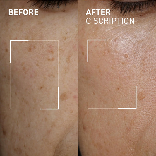 Dr. Brandt Bright This Way C Scription serum dropper enabling precise two-pump application.