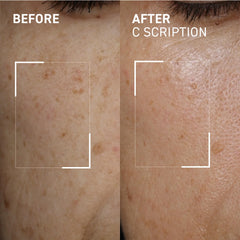 Dr. Brandt Bright This Way C Scription serum dropper enabling precise two-pump application.
