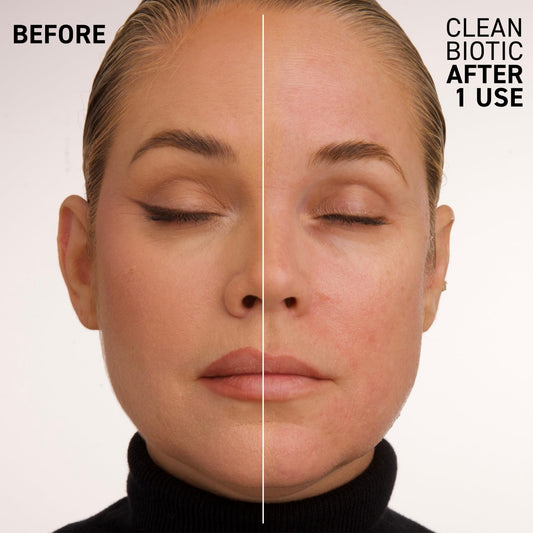 Dr. Brandt Clean Biotic yogurt cleanser texture on hand for gentle cleansing