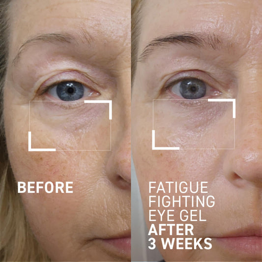 Closeup of Dr. Brandt iD-STRESS eye gel tube highlighting packaging.