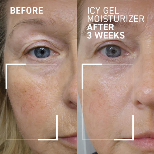 Dr. Brandt iD-STRESS gel texture ready for instant skin refresh