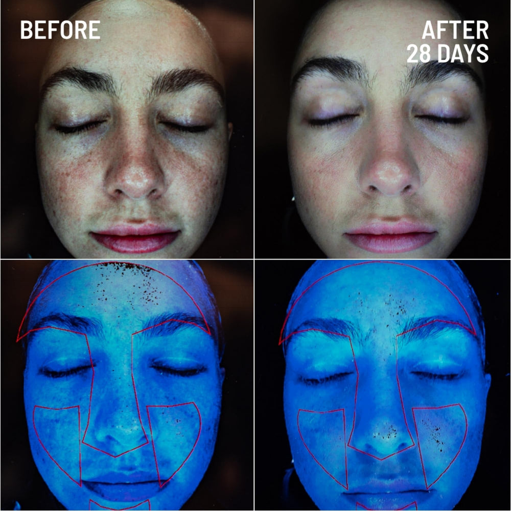 Dr. Brandt microdermabrasion microgranules close-up highlight gentle physical exfoliation.