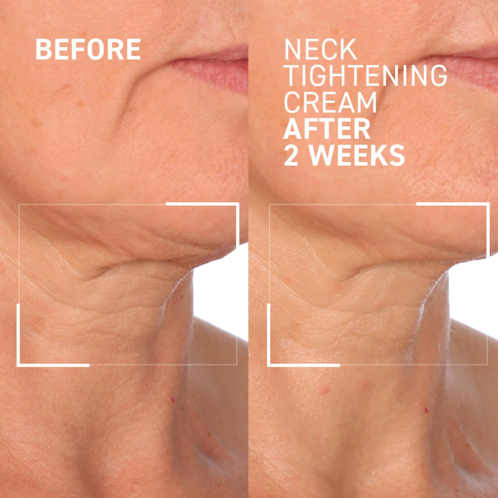 Dr Brandt neck tightening cream applied with upward strokes for lifting.