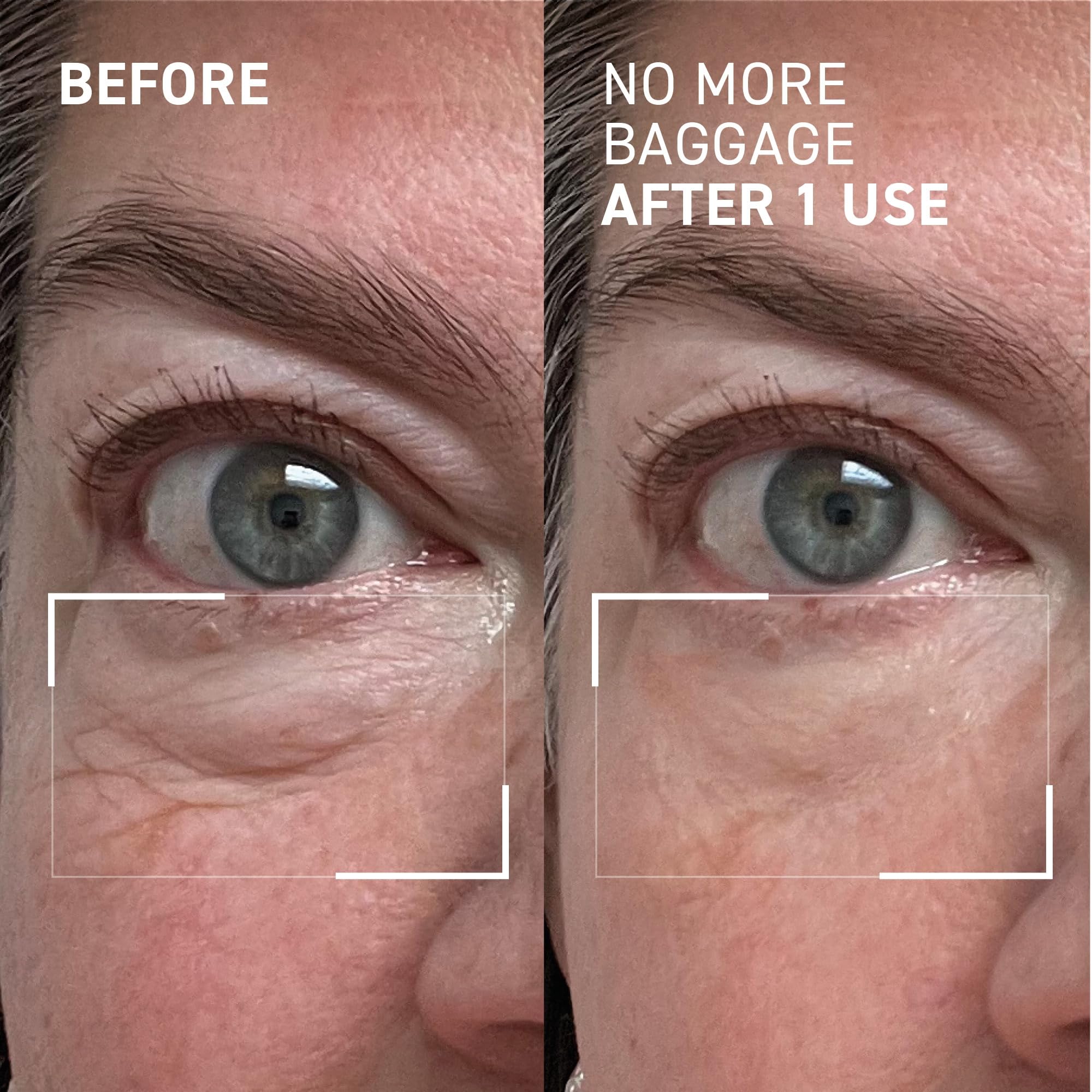 Dr. Brandt Needles No More Baggage close-up texture shows rapid absorption.