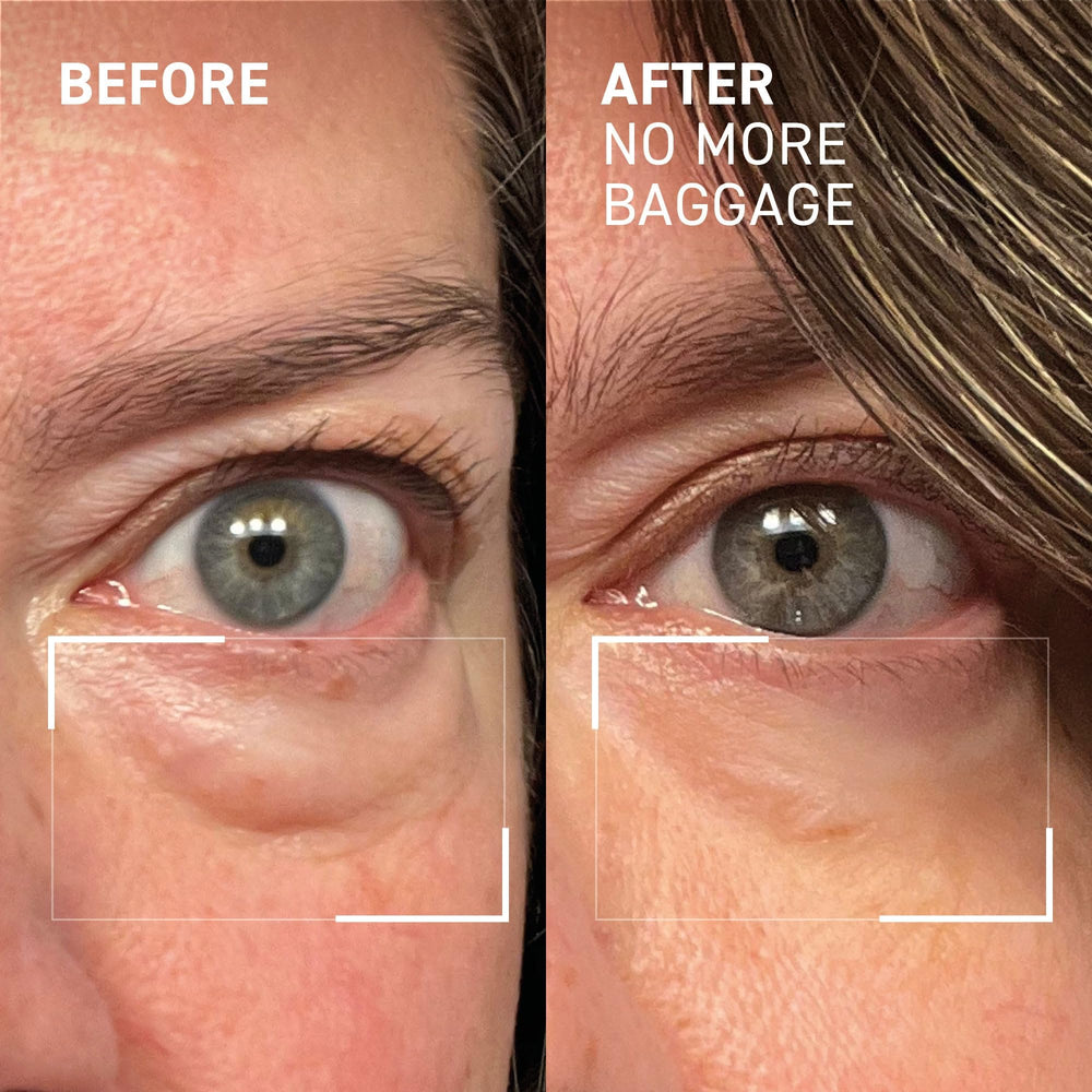 Dr. Brandt Needles No More Baggage jumbo-size convenience on vanity.