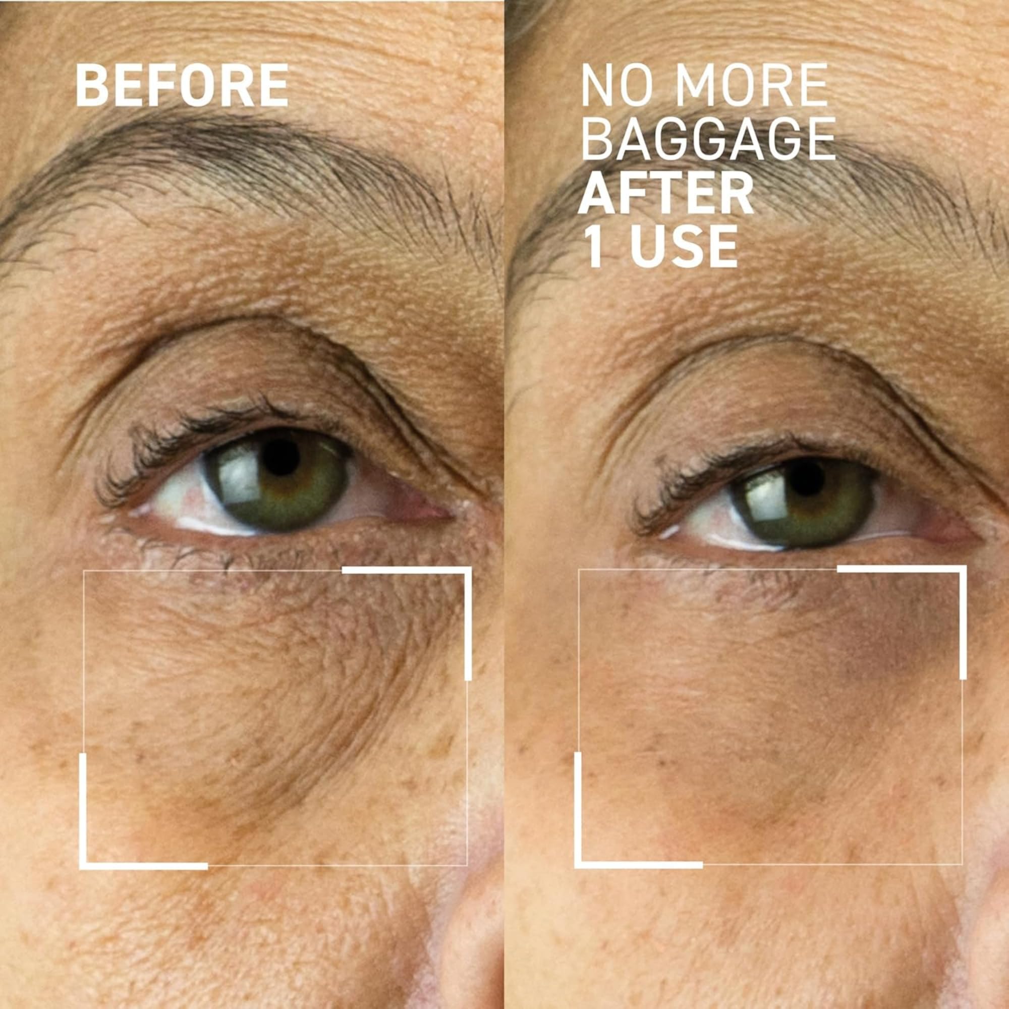 Dr Brandt Needles No More Baggage travel bottle for on-the-go refresh and reduced puffiness