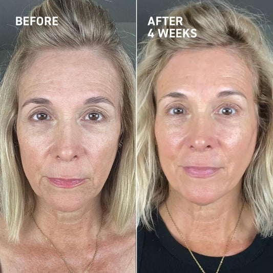 Dr. Brandt Needles No More application scene for nightly skin ritual