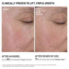 Dr. Brandt Needles No More gel-on-skin emphasizes texture refinement