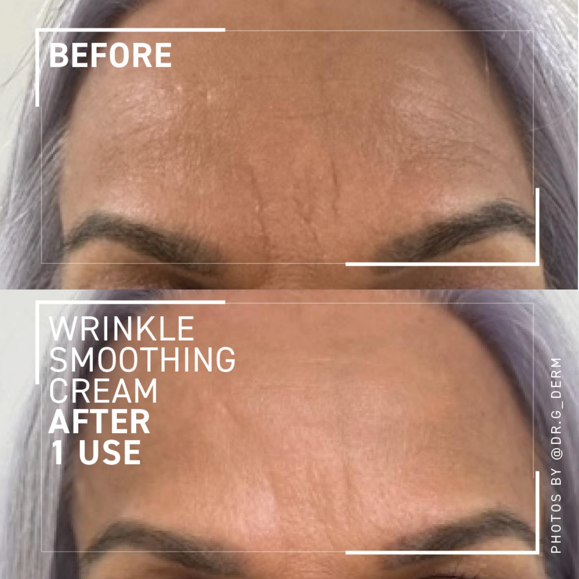 Closeup of the Dr. Brandt Needles No More Wrinkle Smoothing Cream bottle for easy daily application.