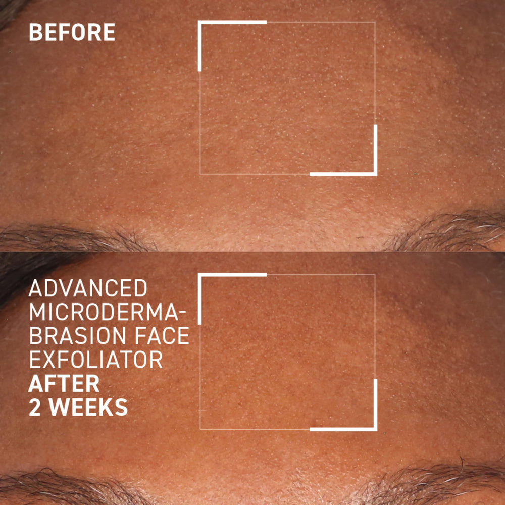 Texture close-up reveals smoother, more even skin.
