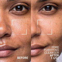 Close-up texture reveals Pores No More dissolving impurities.
