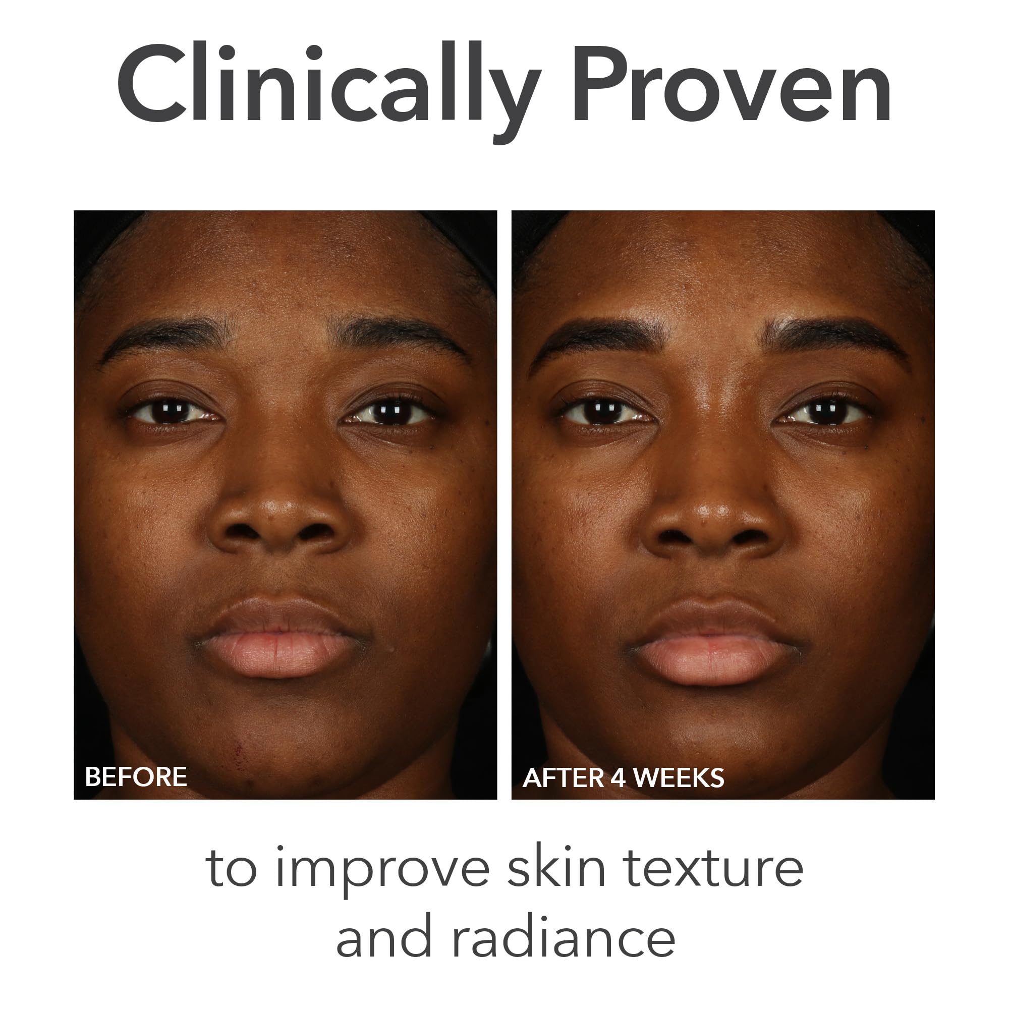 Dr Dennis Gross Alpha Beta Balance texture close-up reveals smooth, balanced skin potential after use.