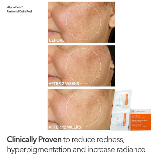 Dr Dennis Gross Alpha Beta Universal Daily Peels in tray for refined texture