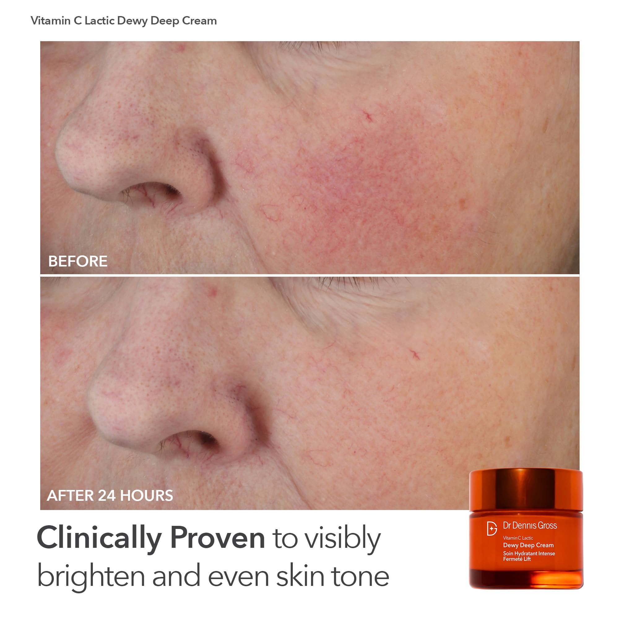 Dr Dennis Gross anti-aging kit gift set offers premium at-home skincare.