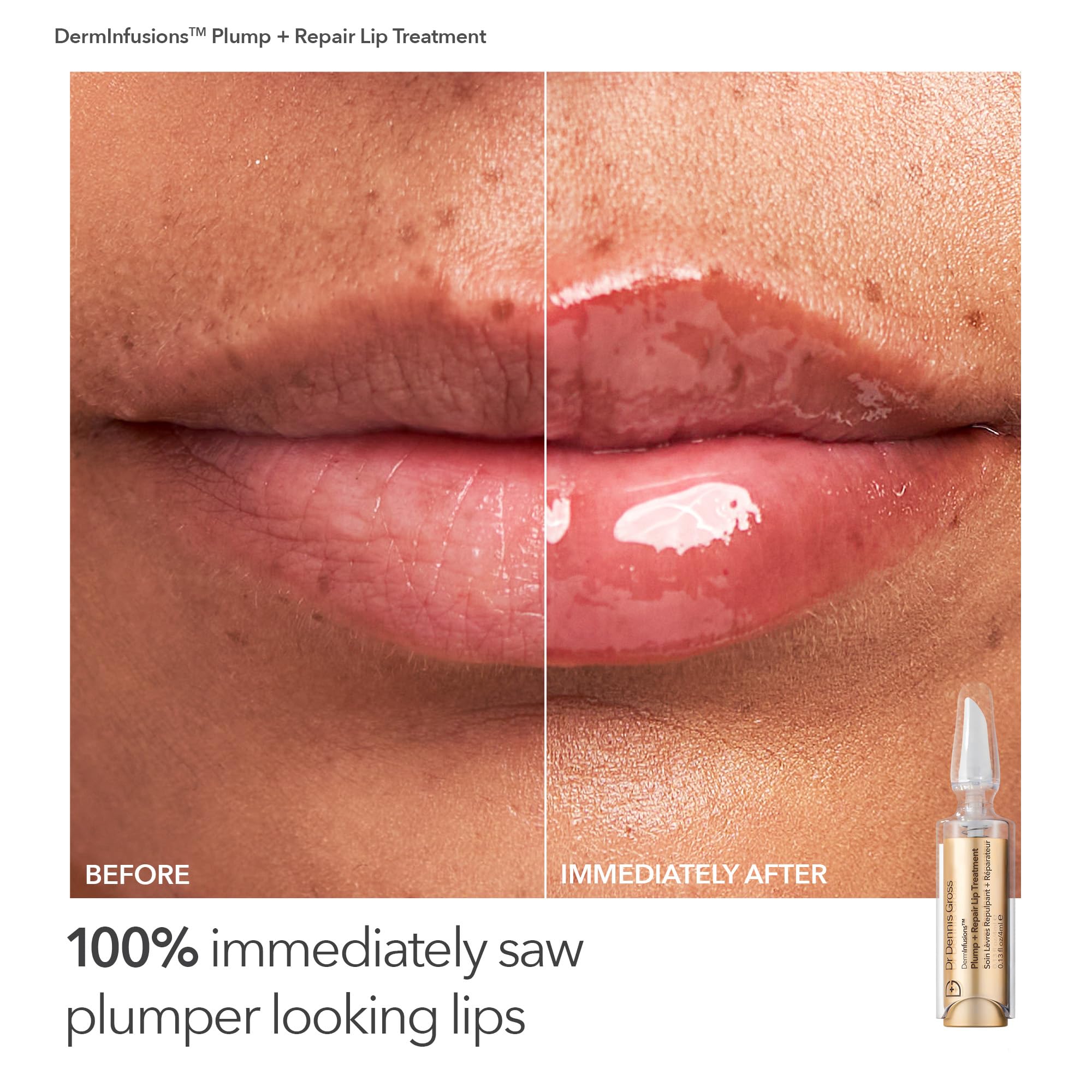 Dr Dennis Gross DermInfusions Kit front showcases a complete hydrating regimen.