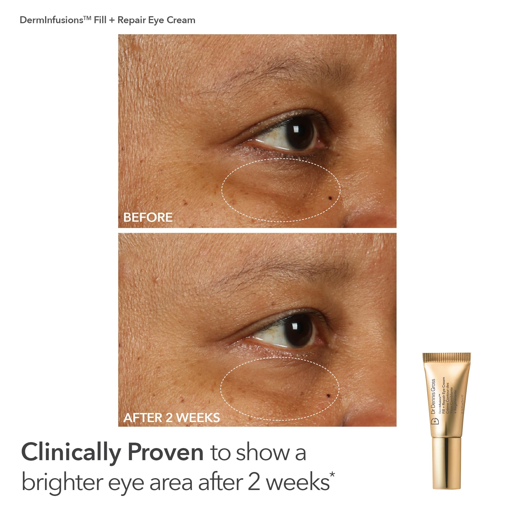 Dr Dennis Gross Eye Cream dab provides targeted hydration around the eyes.