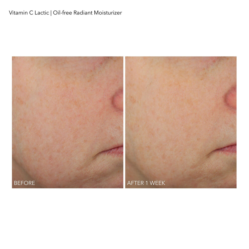 Dr Dennis Gross VitC+Lactic moisturizer applied on skin
