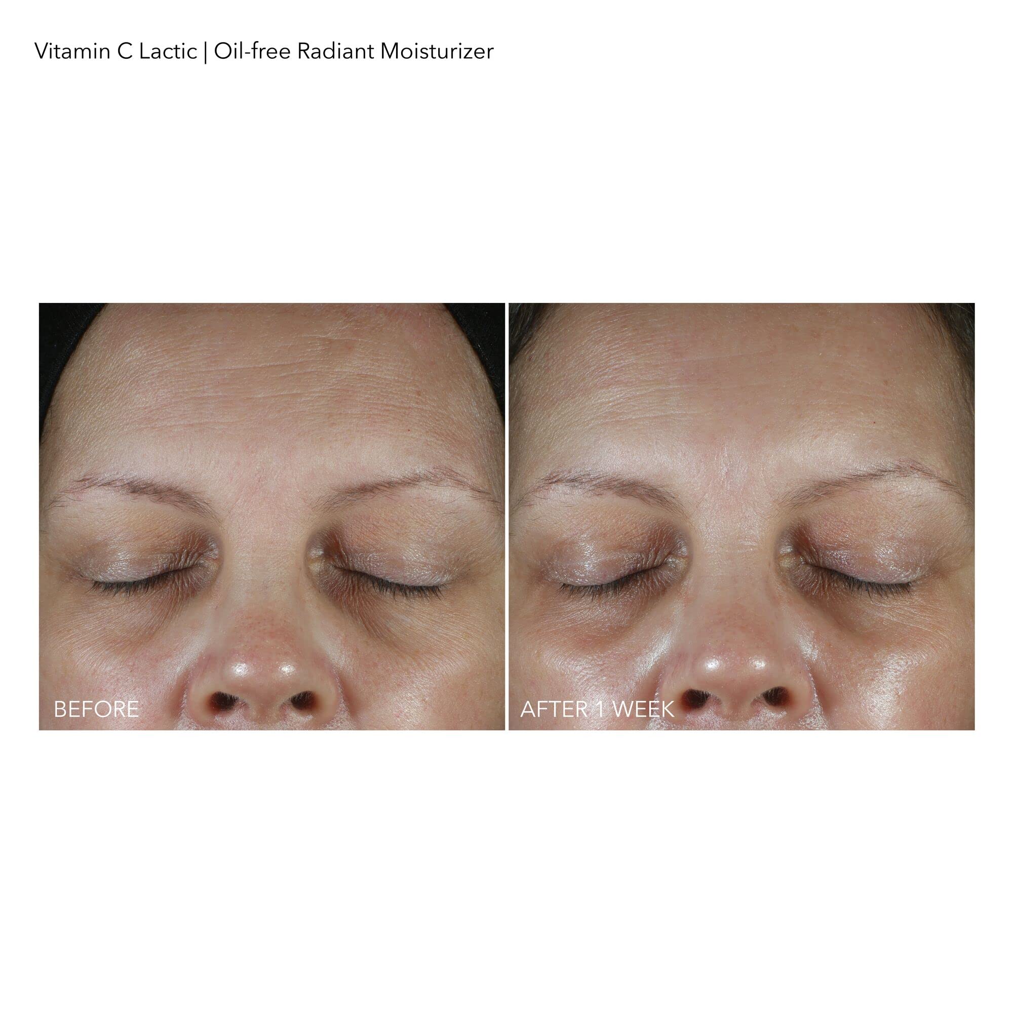 Dr Dennis Gross VitC+Lactic close-up on clean face