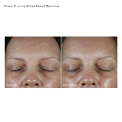 Dr Dennis Gross VitC+Lactic close-up on clean face