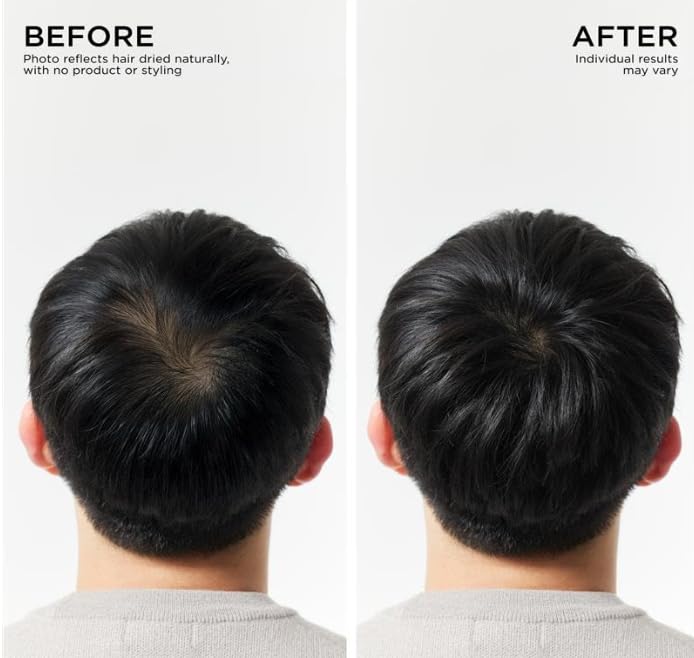 Dr Groot ingredients closeup with rosemary and biotin showing scalp support
