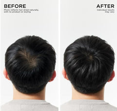Dr Groot ingredients closeup with rosemary and biotin showing scalp support