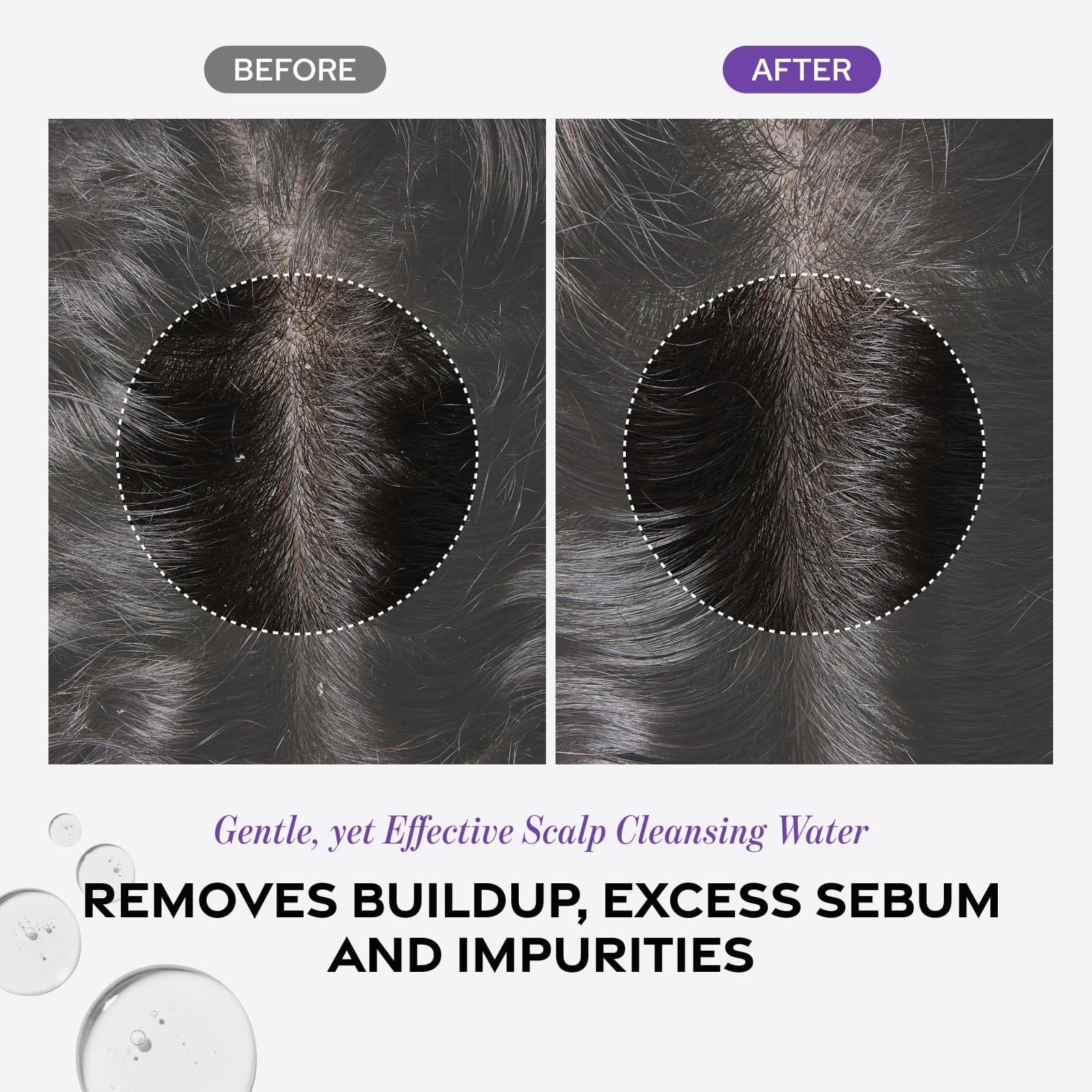 Dr. Groot Microbiome cleansing close-up depicts buildup removal for healthier scalp environment