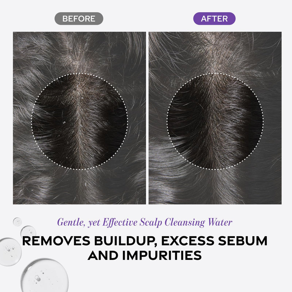 Dr. Groot Microbiome cleansing close-up depicts buildup removal for healthier scalp environment