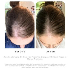 Dr. Groot application on scalp illustrating massage and exfoliation benefit