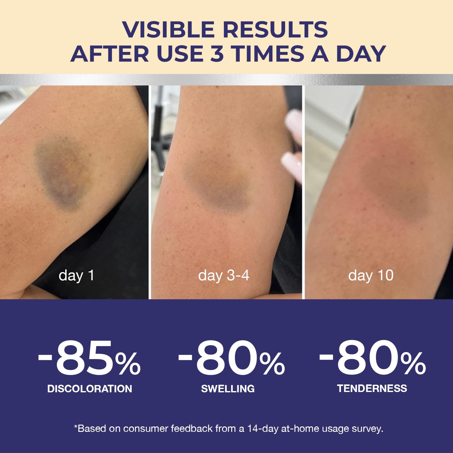 Packaging of Dr. Luke Arnica Bruise Cream signaling medical-grade care