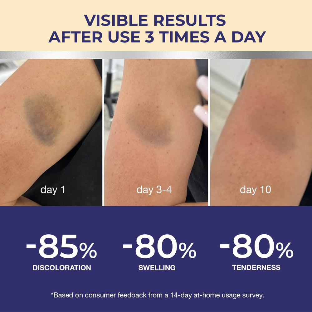 Packaging of Dr. Luke Arnica Bruise Cream signaling medical-grade care