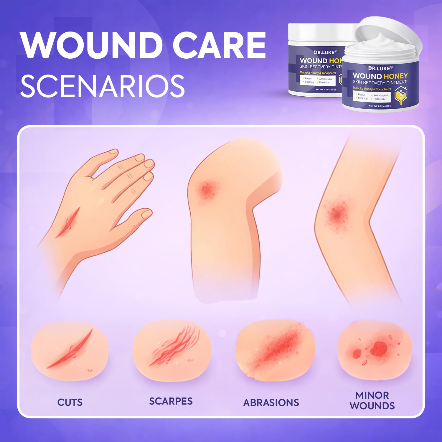 Dr. Luke Manuka Honey Wound Gel tube showing smooth, non greasy texture
