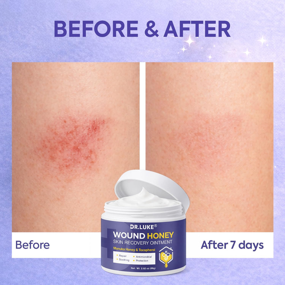 Dr. Luke Manuka Honey Wound Gel with Vitamin E for nourishment