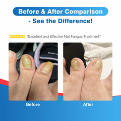 DR.RAPID pen dries quickly with minimal mess during use