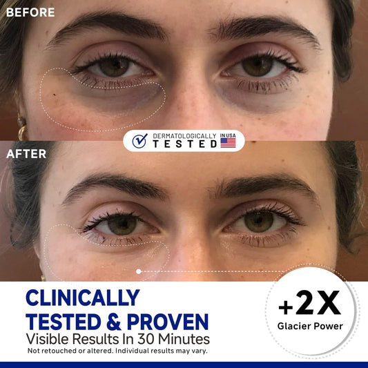 Dr Vincent Peptide Cooling Under Eye Patch with no-slip grip stays securely in place.
