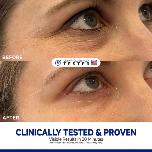 Dr Vincent peptide jojoba patches applied to eye area for refreshing hydration.