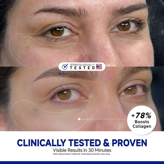 Dr Vincent Peptide Under Eye Patches grip-texture design secures during activities