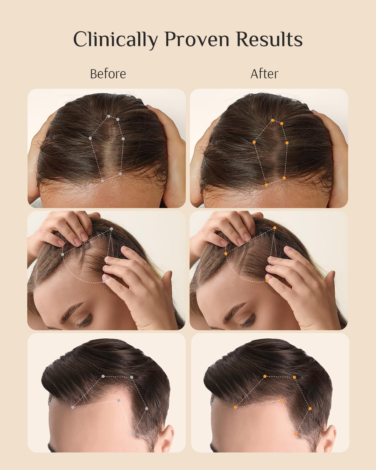 Pouring DR ZERO Redenical conditioner bottle for a wash routine.