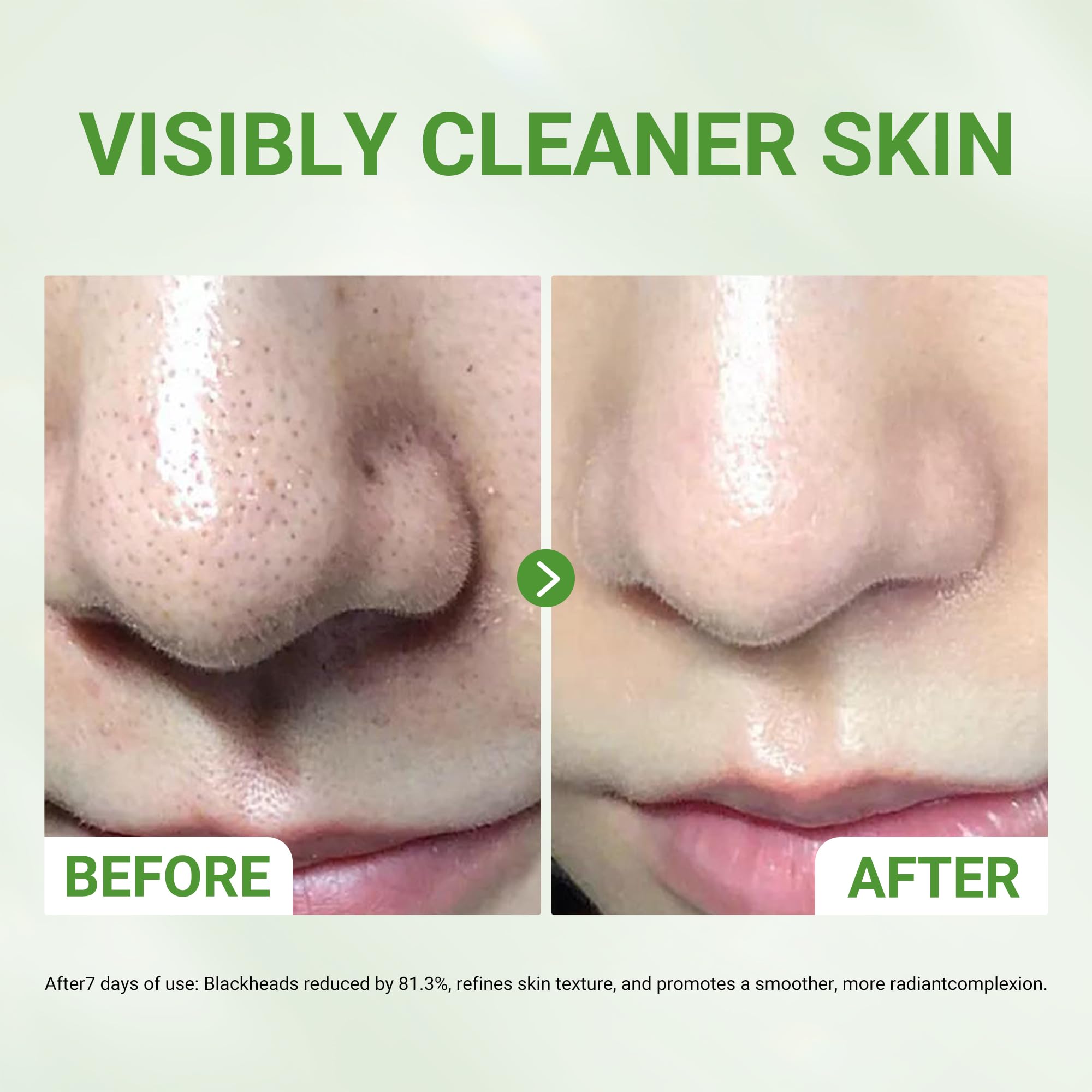 Dr.Leo mask performs deep pore cleansing by drawing out impurities for refreshed skin.