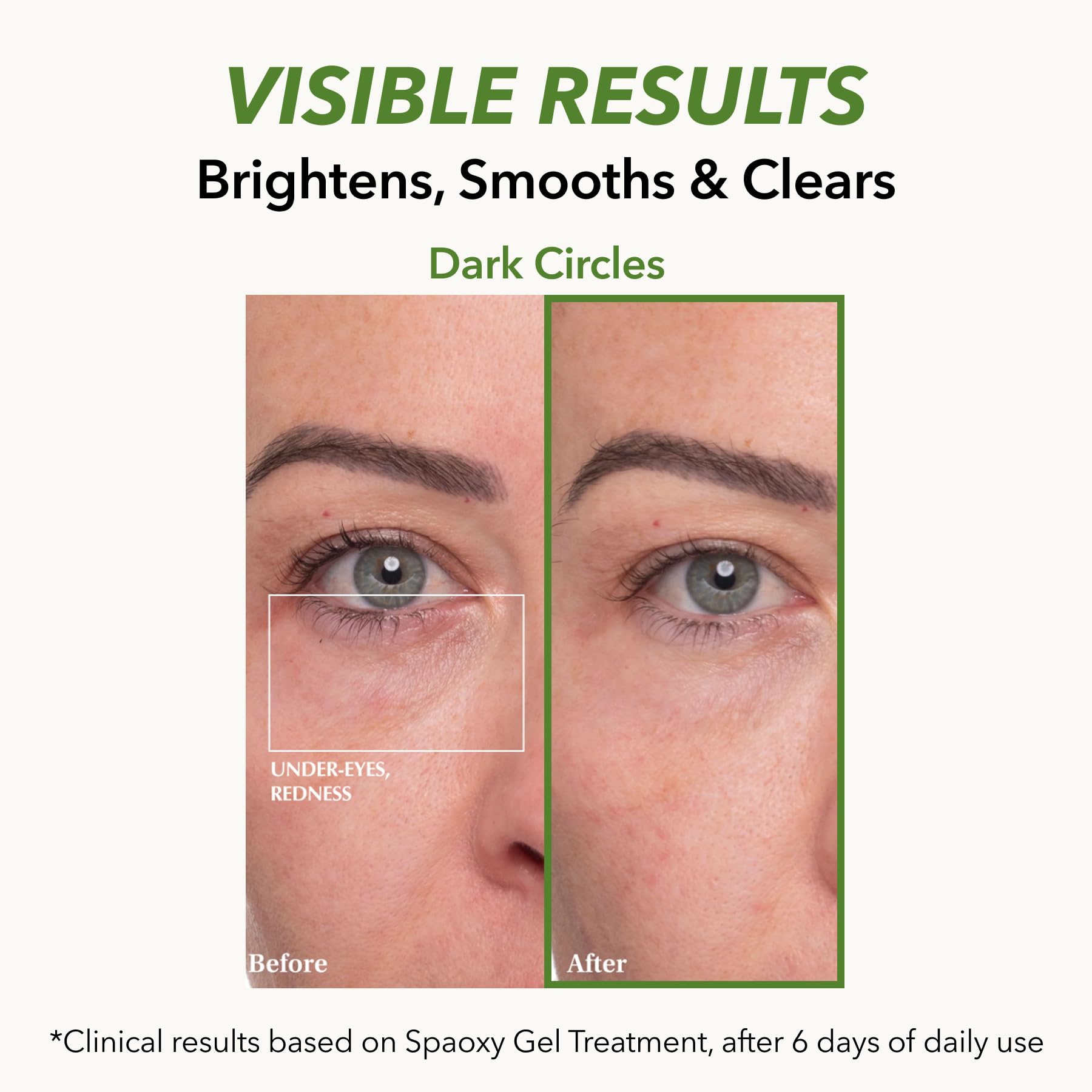 Dr. MEDION Spaoxy CO2 bubbling action illustrates at-home treatment concept.