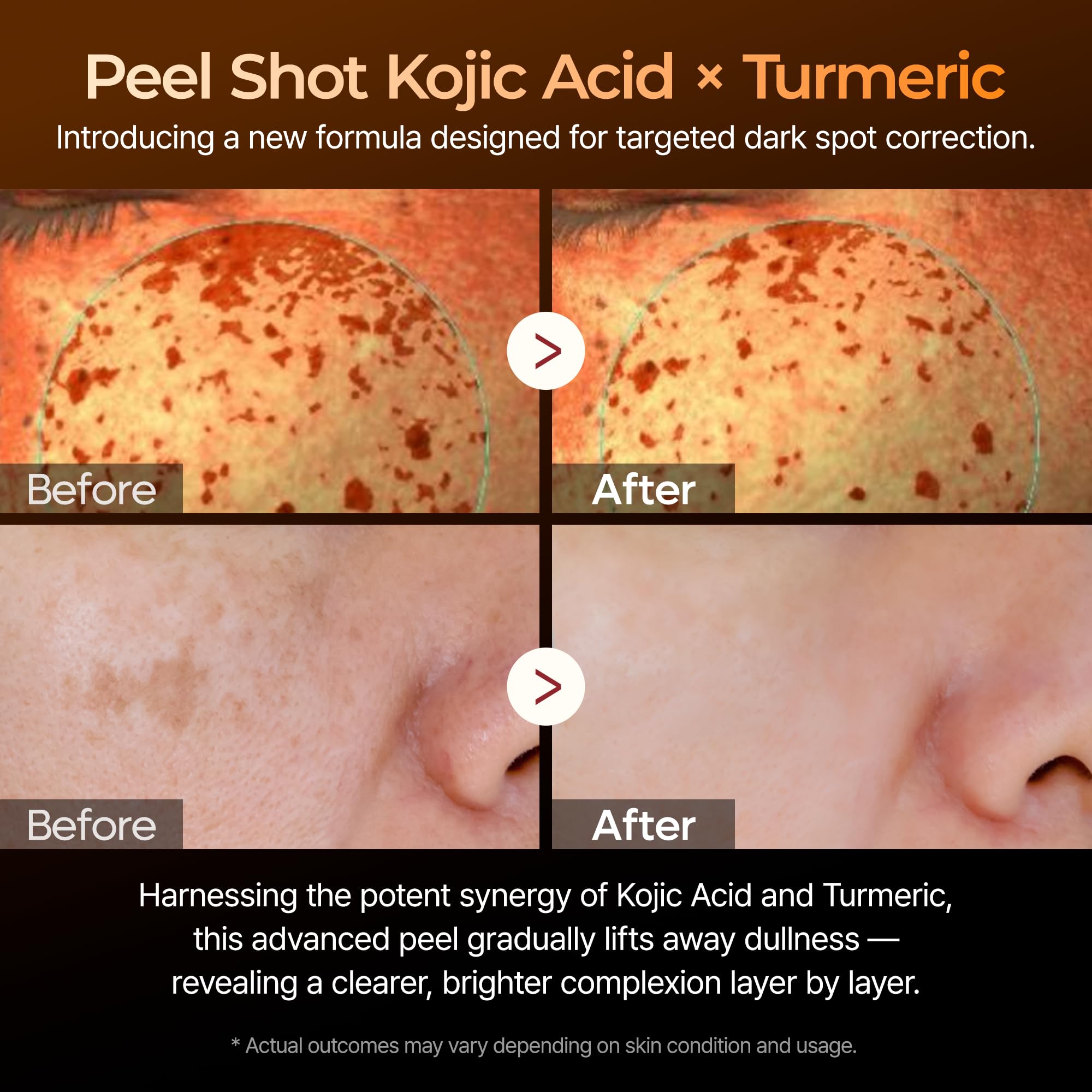 Dr.Melaxin Peel Shot serum dropper close-up for precise dosing