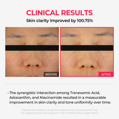 Dr.Melaxin TXA mask application close-up demonstrates overnight layering for glow.